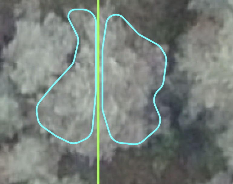 Figure 3. An example of a) splitting an image into patches and b) a possible error in segmentation of marginal areas.